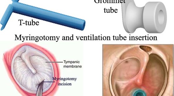 添翼2017-2018年ISPN/RN專業(yè)課&nbsp;38章&nbsp;眼耳鼻喉疾病