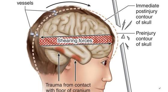 添翼ISPN/RN專業(yè)課42章&nbsp;神經(jīng)與認(rèn)知問題