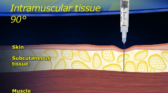 添翼2017-2018年ISPN/RN專業(yè)課45章&nbsp;兒童用藥
